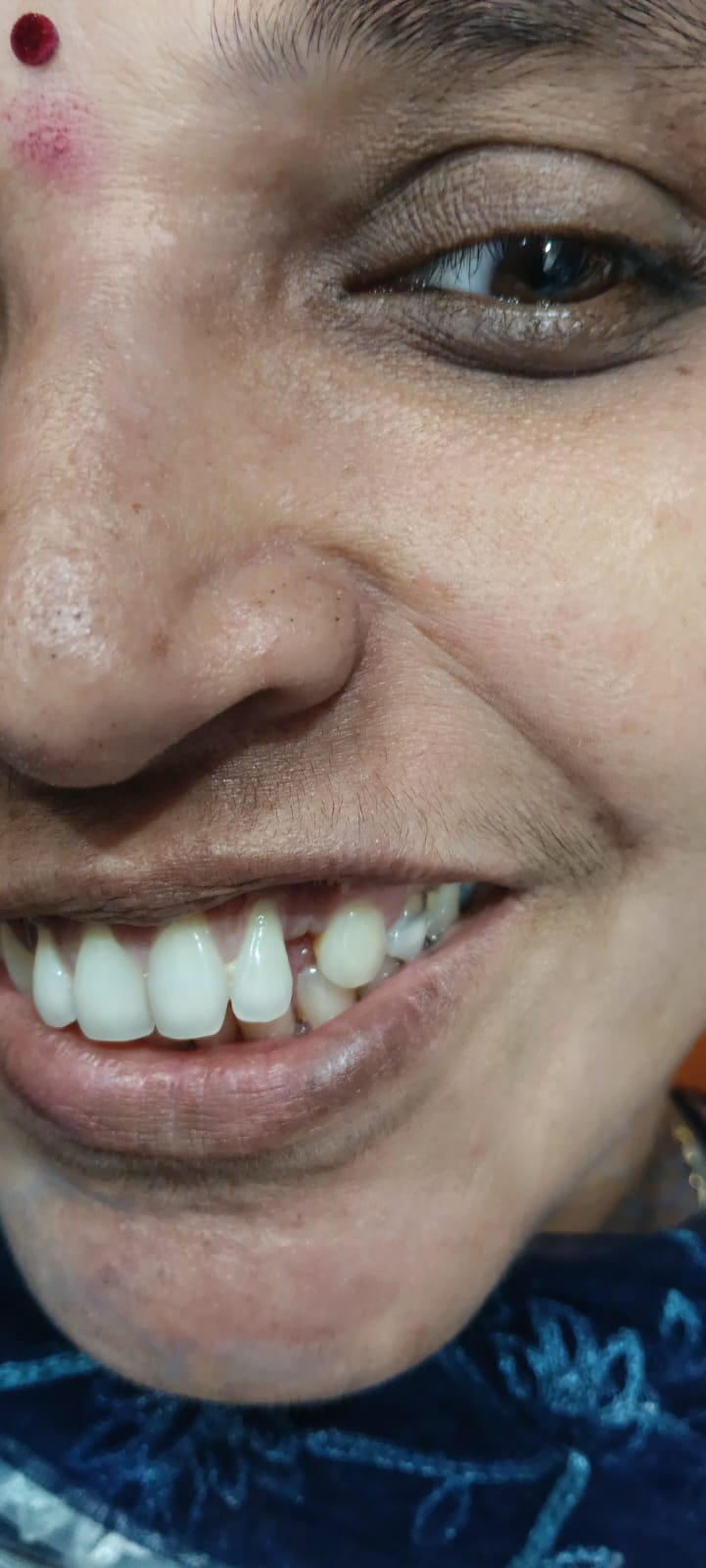 Happy Patient